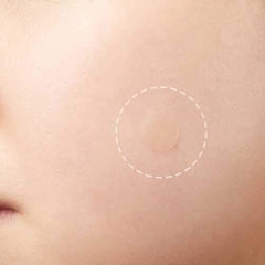 24Pcs Face Spot Scar Care Treatment Stickers Acne Patches